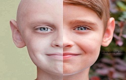 کدام نوع از سرطان‌ها در ایران شایع ترند و چرا؟